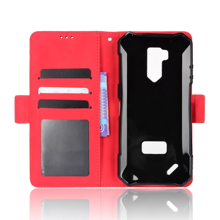 For Ulefone Armor X9 Skin Feel Calf Pattern Leather Phone Case