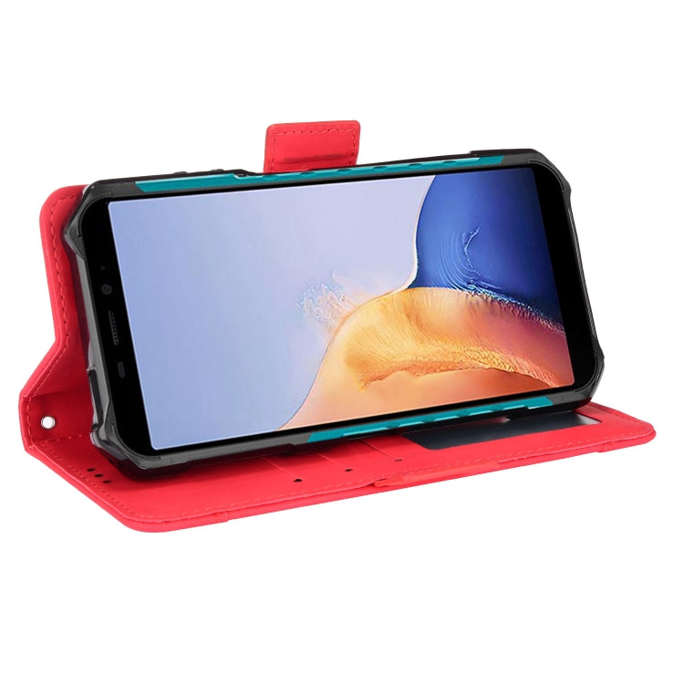 For Ulefone Armor X9 Skin Feel Calf Pattern Leather Phone Case