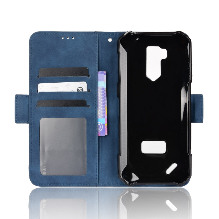 For Ulefone Armor X9 Skin Feel Calf Pattern Leather Phone Case