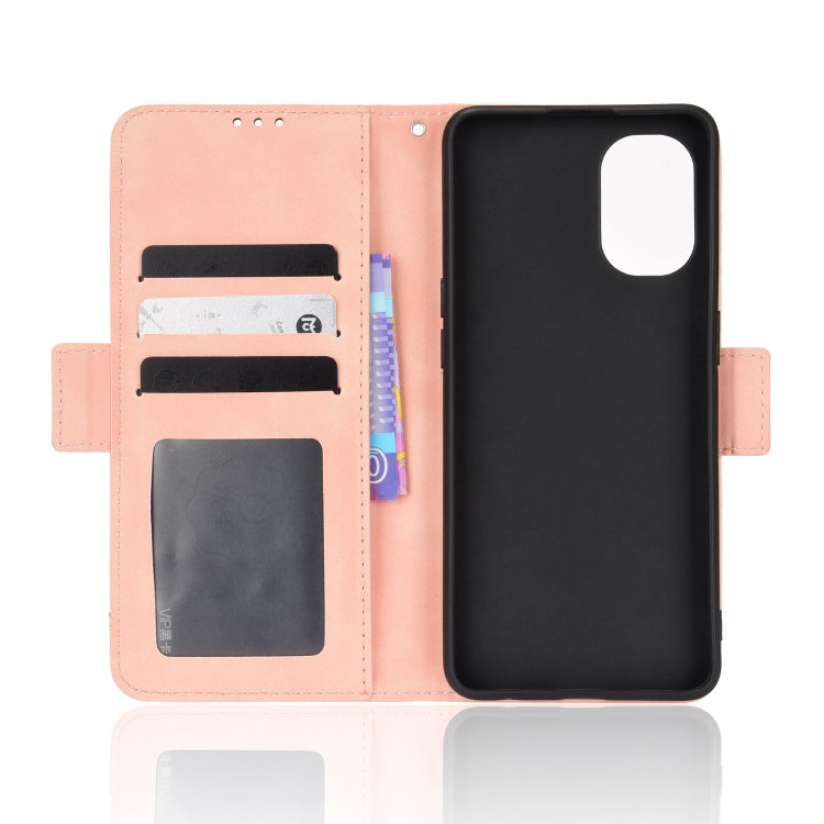 For OnePlus Nord N20 5G Skin Feel Calf Pattern Leather Phone Case