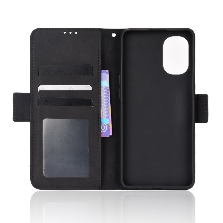 For OnePlus Nord N20 5G Skin Feel Calf Pattern Leather Phone Case