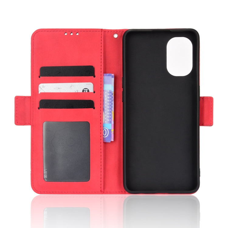 For OnePlus Nord N20 5G Skin Feel Calf Pattern Leather Phone Case