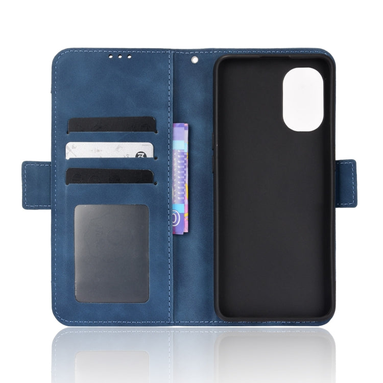For OnePlus Nord N20 5G Skin Feel Calf Pattern Leather Phone Case