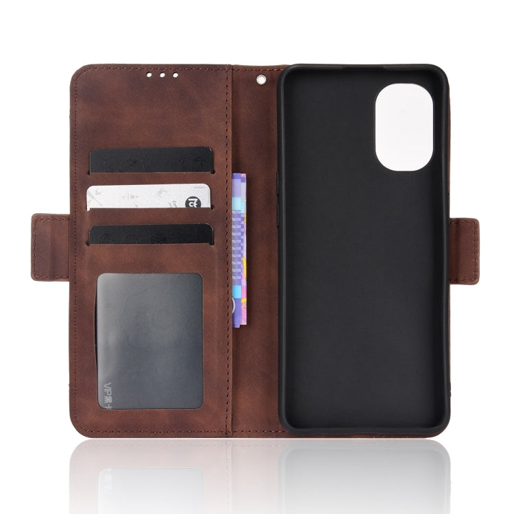 For OnePlus Nord N20 5G Skin Feel Calf Pattern Leather Phone Case