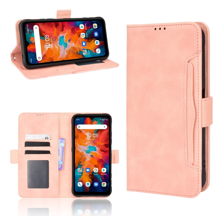 For UMIDIGI BISON X10 Skin Feel Calf Pattern Leather Phone Case