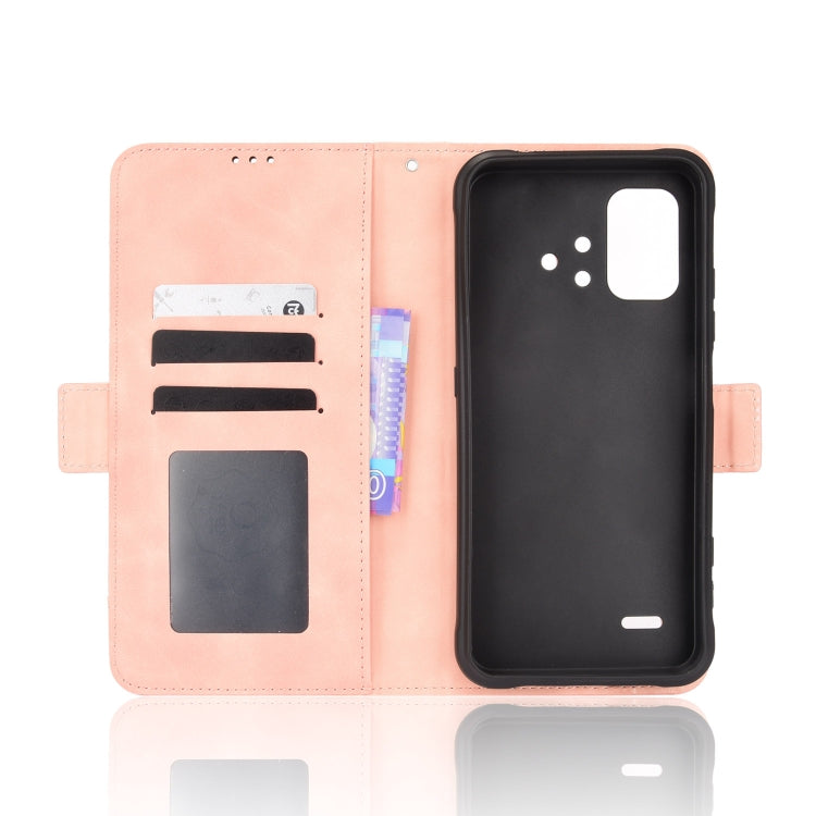For UMIDIGI BISON X10 Skin Feel Calf Pattern Leather Phone Case