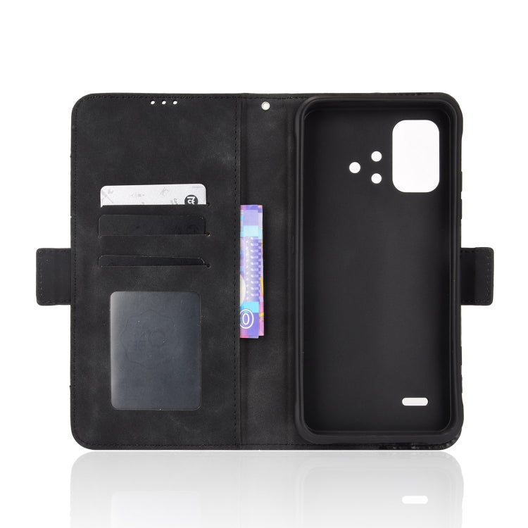 For UMIDIGI BISON X10 Skin Feel Calf Pattern Leather Phone Case