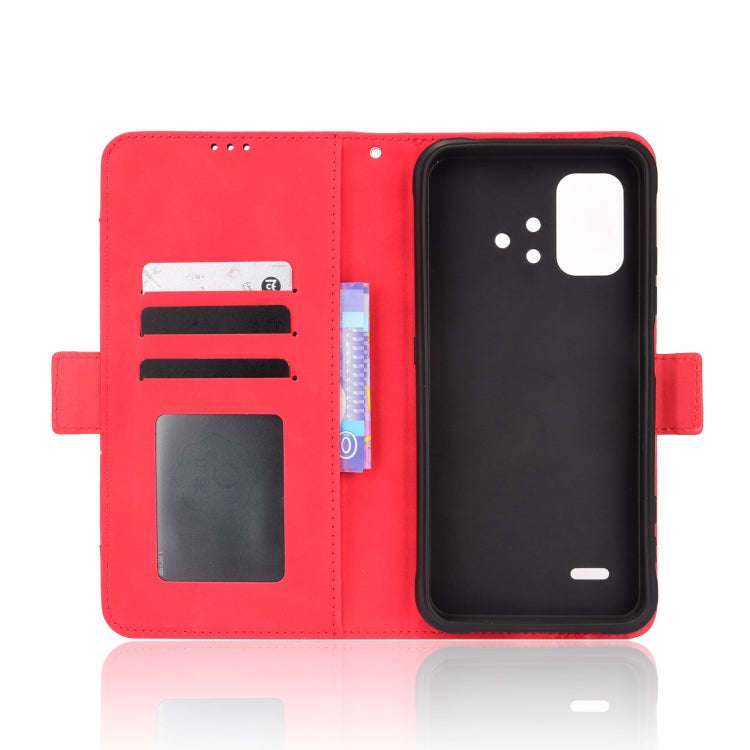 For UMIDIGI BISON X10 Skin Feel Calf Pattern Leather Phone Case