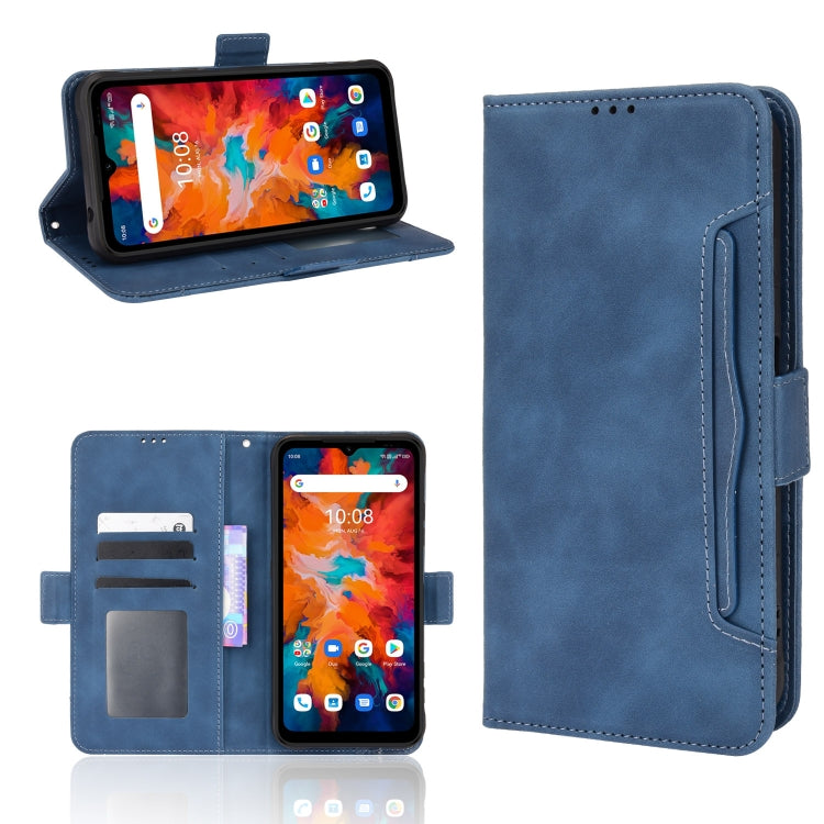 For UMIDIGI BISON X10 Skin Feel Calf Pattern Leather Phone Case