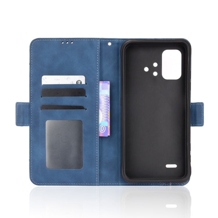 For UMIDIGI BISON X10 Skin Feel Calf Pattern Leather Phone Case