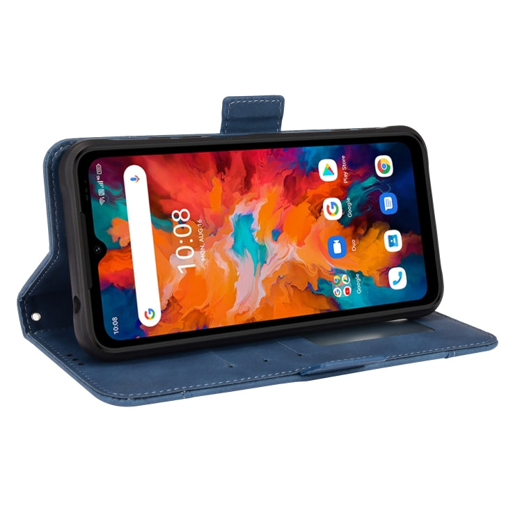 For UMIDIGI BISON X10 Skin Feel Calf Pattern Leather Phone Case