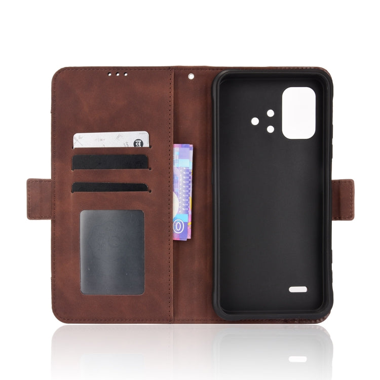 For UMIDIGI BISON X10 Skin Feel Calf Pattern Leather Phone Case