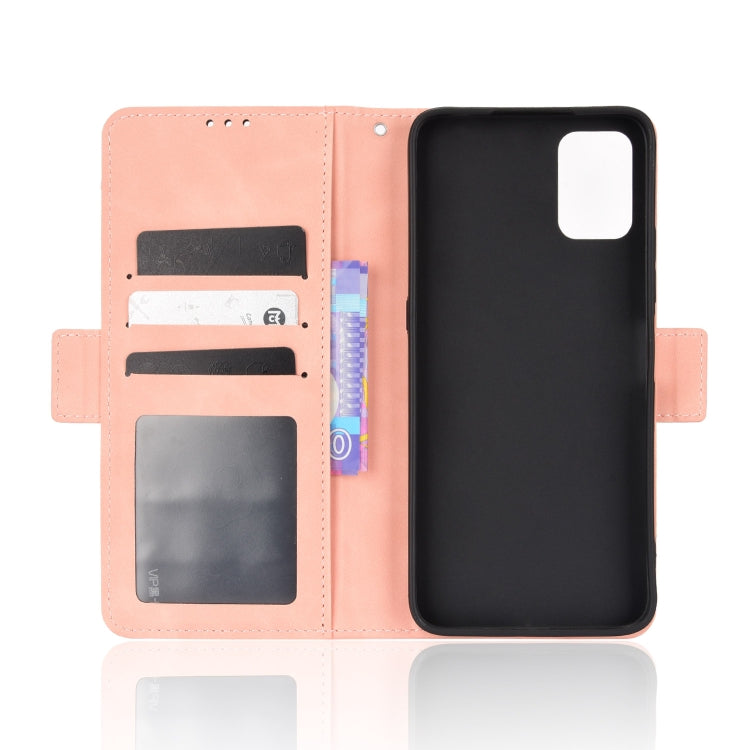 For UMIDIGI Power 5S Skin Feel Calf Pattern Leather Phone Case