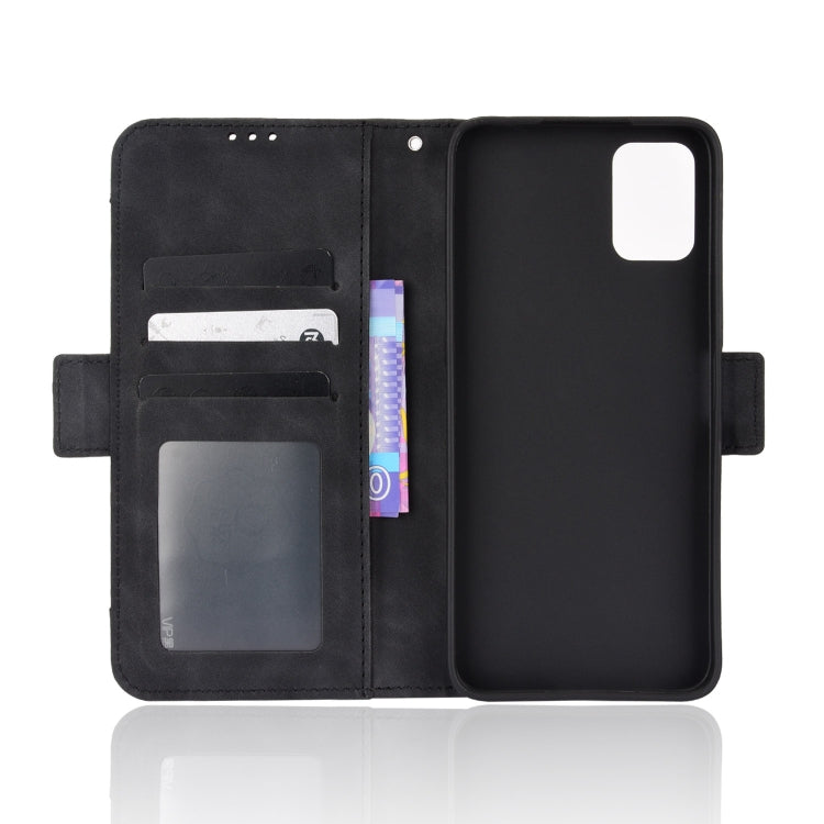 For UMIDIGI Power 5S Skin Feel Calf Pattern Leather Phone Case