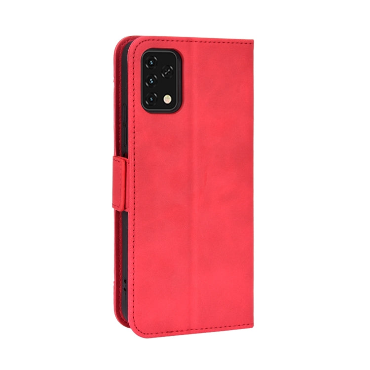 For UMIDIGI Power 5S Skin Feel Calf Pattern Leather Phone Case