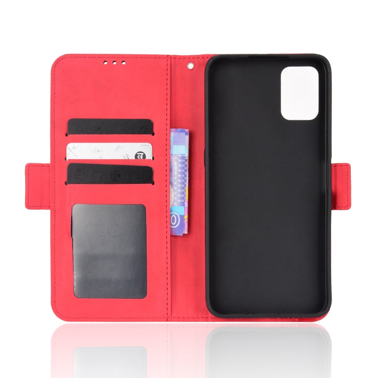 For UMIDIGI Power 5S Skin Feel Calf Pattern Leather Phone Case