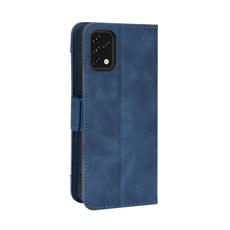 For UMIDIGI Power 5S Skin Feel Calf Pattern Leather Phone Case