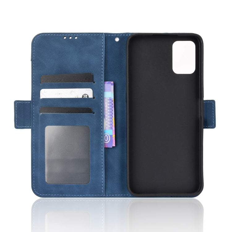 For UMIDIGI Power 5S Skin Feel Calf Pattern Leather Phone Case
