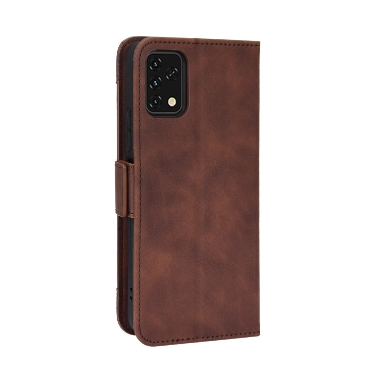 For UMIDIGI Power 5S Skin Feel Calf Pattern Leather Phone Case