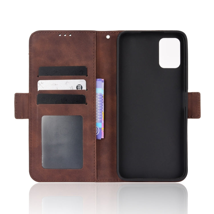 For UMIDIGI Power 5S Skin Feel Calf Pattern Leather Phone Case