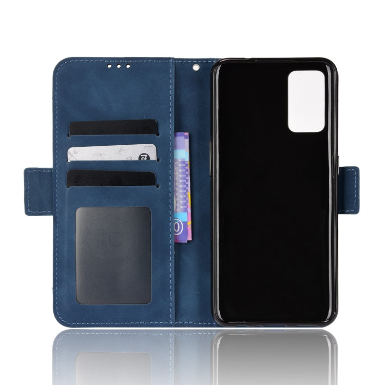 For OPPO A55s 5G JP Version Skin Feel Calf Pattern Leather Phone Case