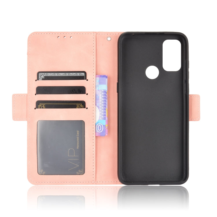 For TCL 20Y / Alcatel 1S 2021 Skin Feel Calf Pattern Leather Phone Case