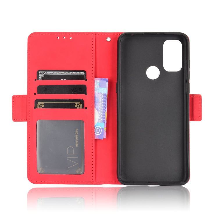 For TCL 20Y / Alcatel 1S 2021 Skin Feel Calf Pattern Leather Phone Case