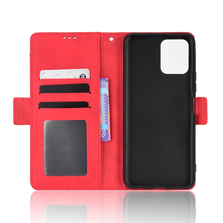 For vivo Y15s 2021 / Y15a Skin Feel Calf Pattern Leather Phone Case