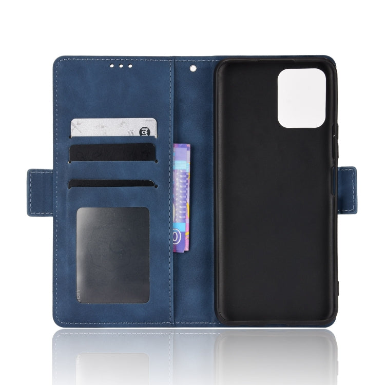 For vivo Y15s 2021 / Y15a Skin Feel Calf Pattern Leather Phone Case