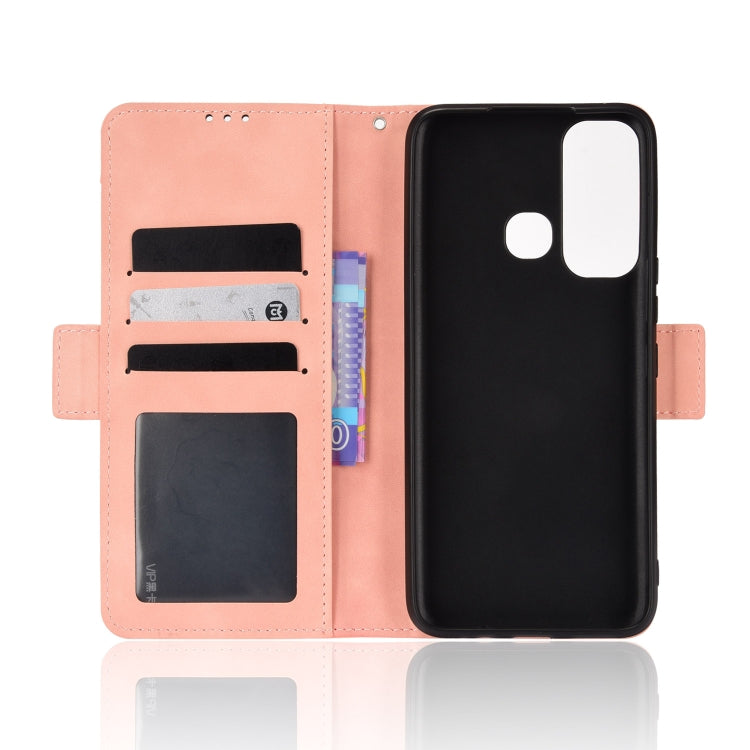 For Infinix Hot 11 Skin Feel Calf Pattern Leather Phone Case