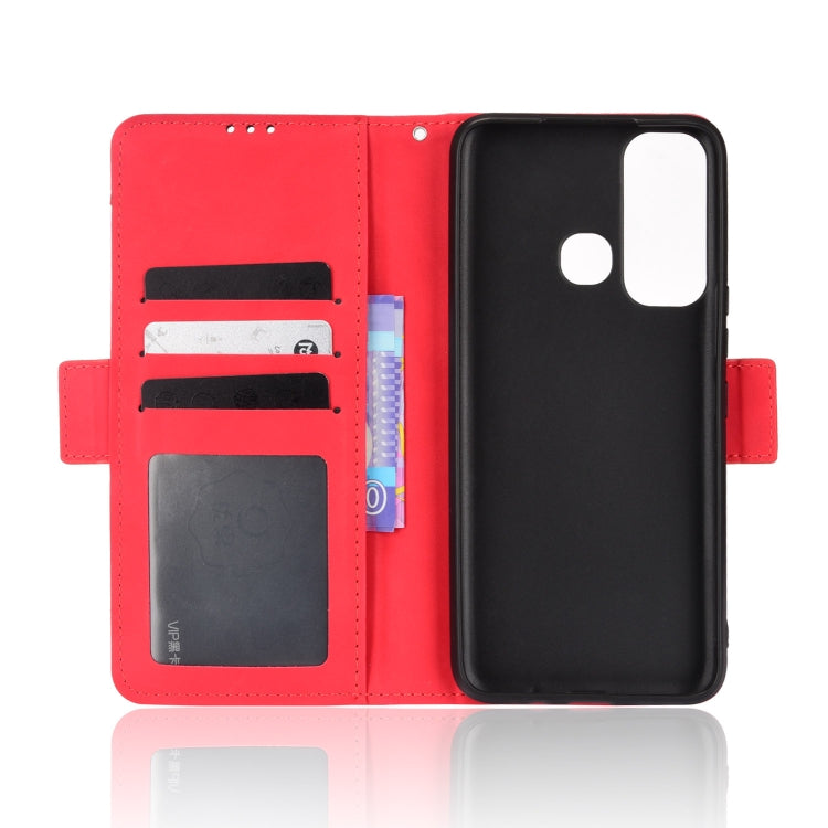 For Infinix Hot 11 Skin Feel Calf Pattern Leather Phone Case