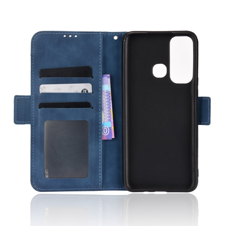 For Infinix Hot 11 Skin Feel Calf Pattern Leather Phone Case