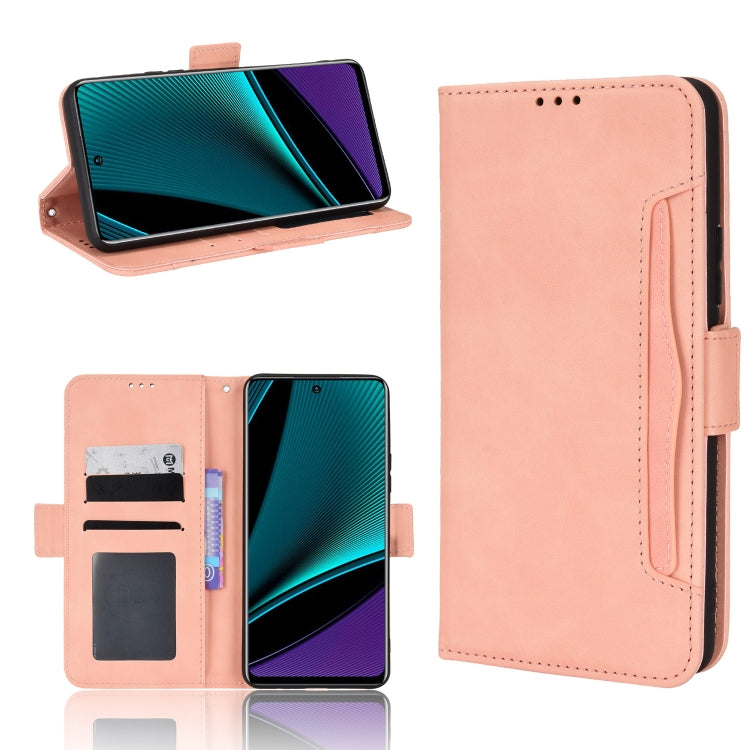 For Infinix Note 11 Pro Skin Feel Calf Pattern Leather Phone Case