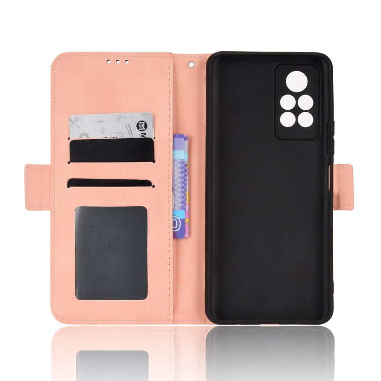 For Infinix Note 11 Pro Skin Feel Calf Pattern Leather Phone Case