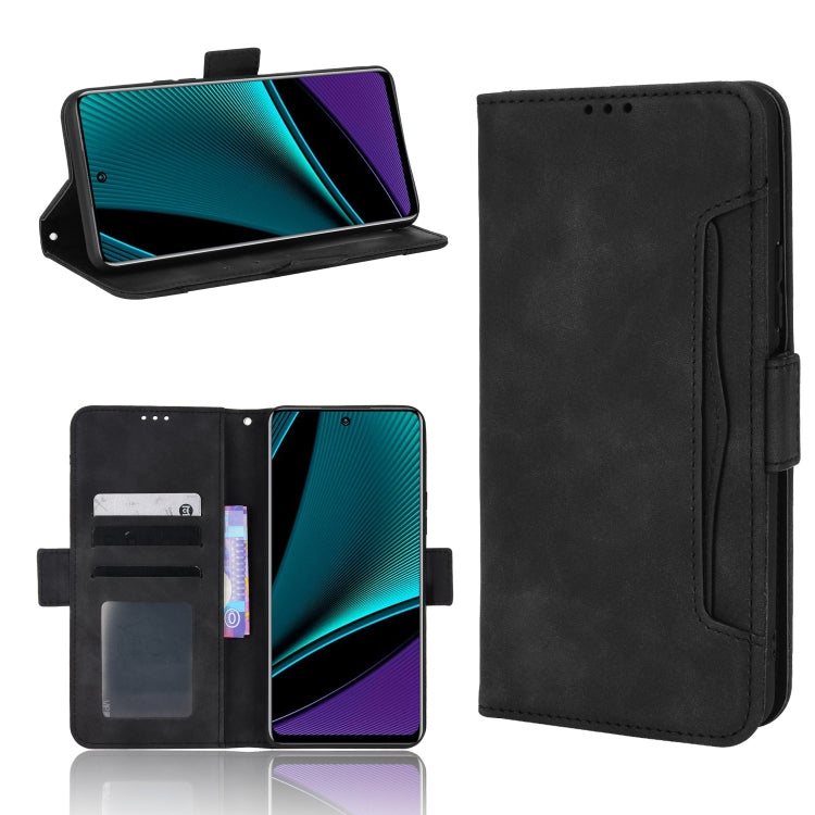 For Infinix Note 11 Pro Skin Feel Calf Pattern Leather Phone Case