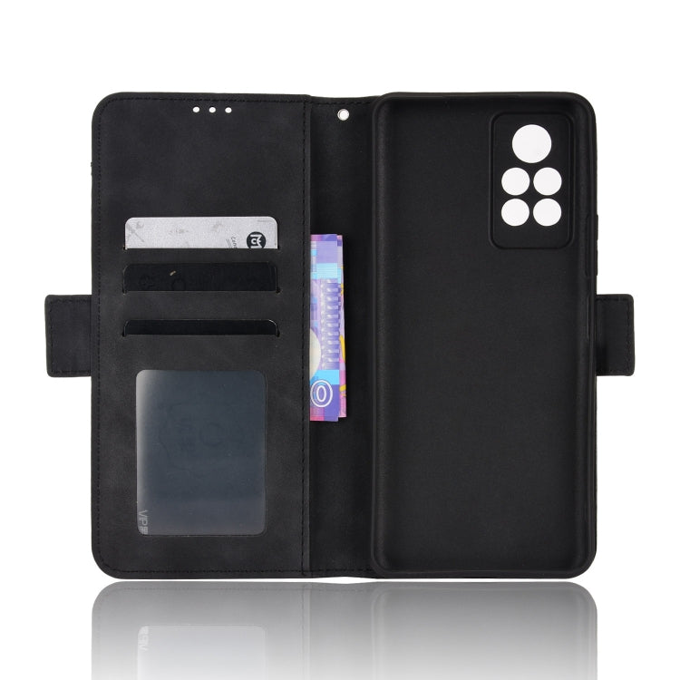 For Infinix Note 11 Pro Skin Feel Calf Pattern Leather Phone Case