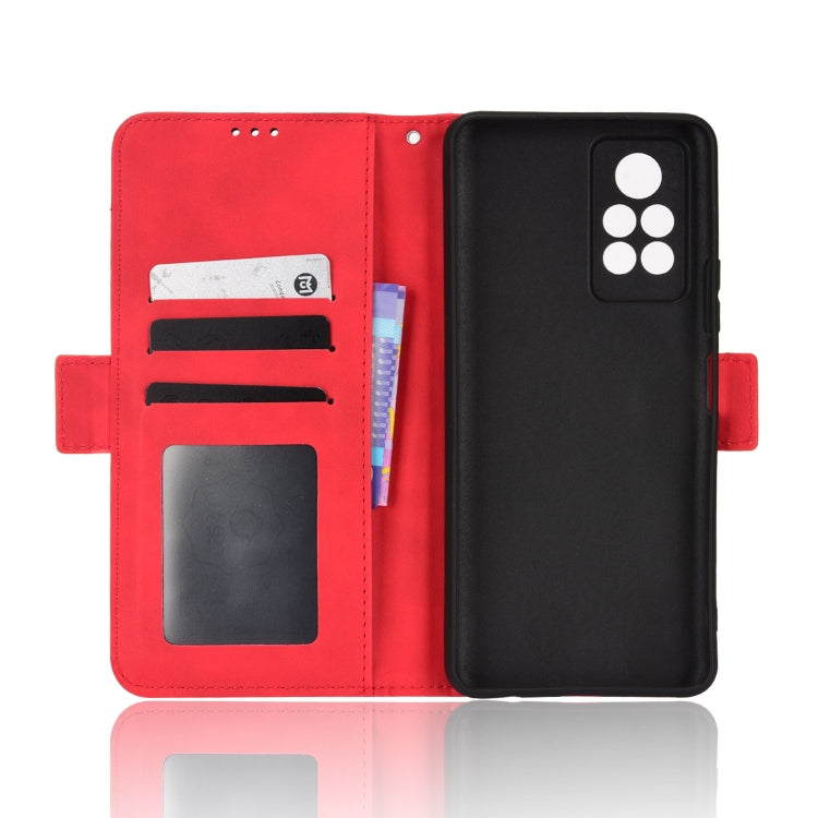 For Infinix Note 11 Pro Skin Feel Calf Pattern Leather Phone Case