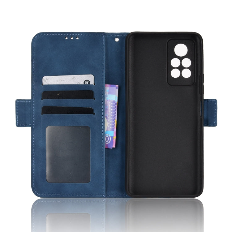 For Infinix Note 11 Pro Skin Feel Calf Pattern Leather Phone Case
