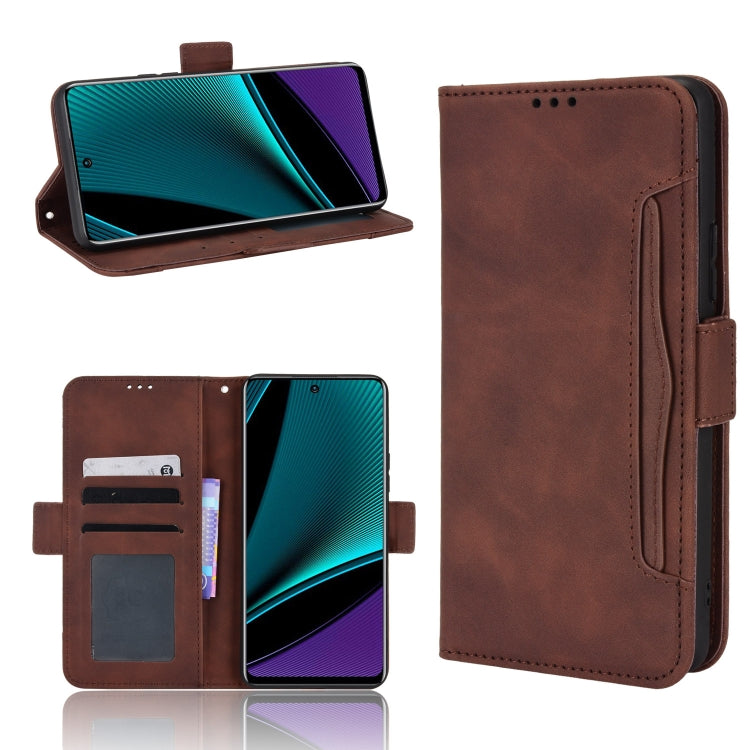 For Infinix Note 11 Pro Skin Feel Calf Pattern Leather Phone Case