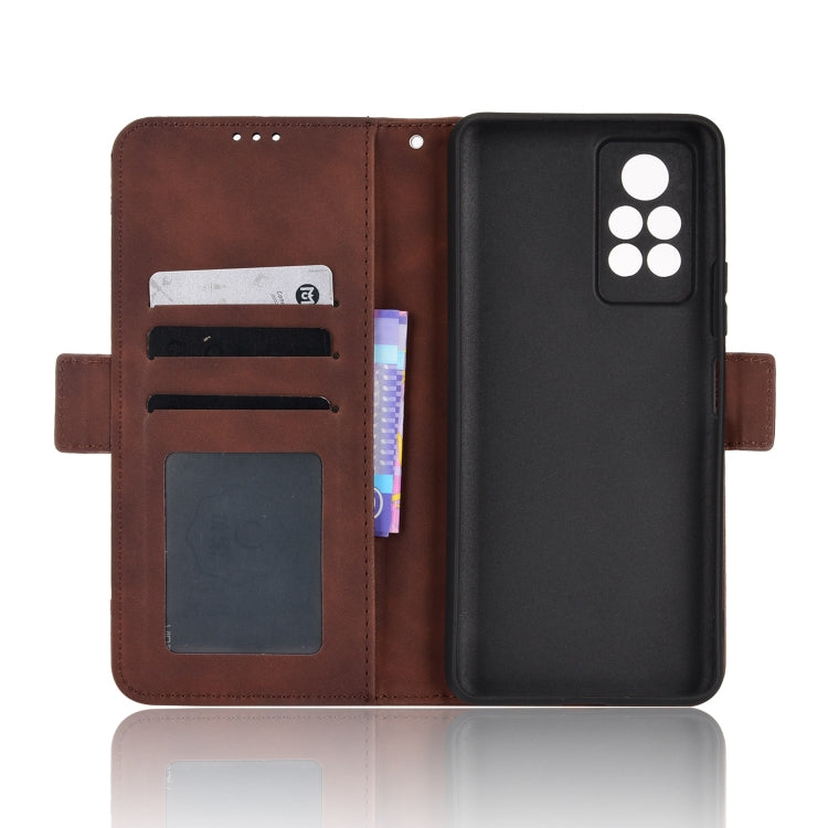 For Infinix Note 11 Pro Skin Feel Calf Pattern Leather Phone Case