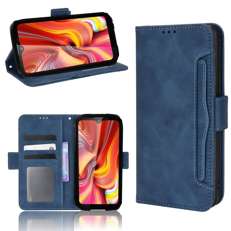 For Doogee S96 Pro Skin Feel Calf Pattern Leather Phone Case
