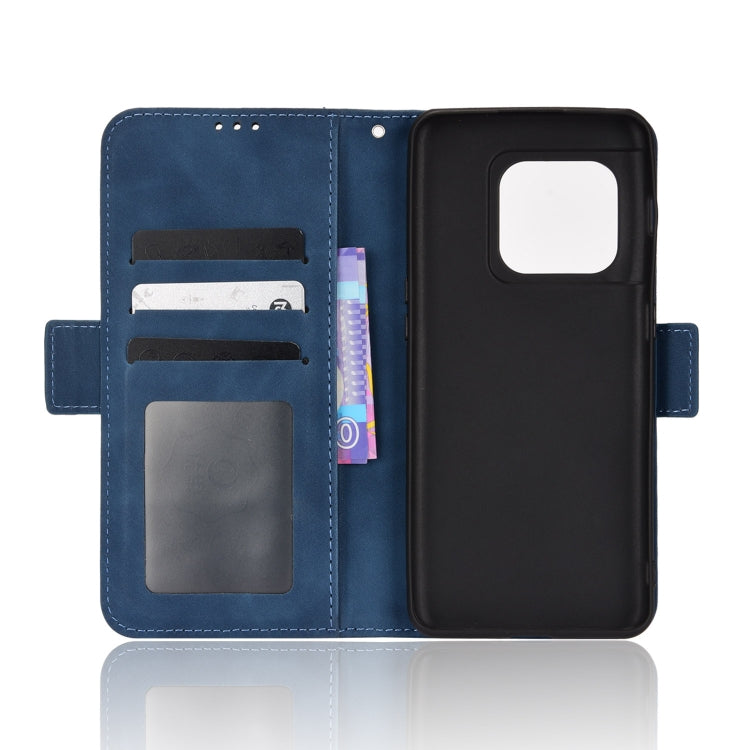 For OnePlus 10 Pro 5G Skin Feel Calf Pattern Leather Phone Case