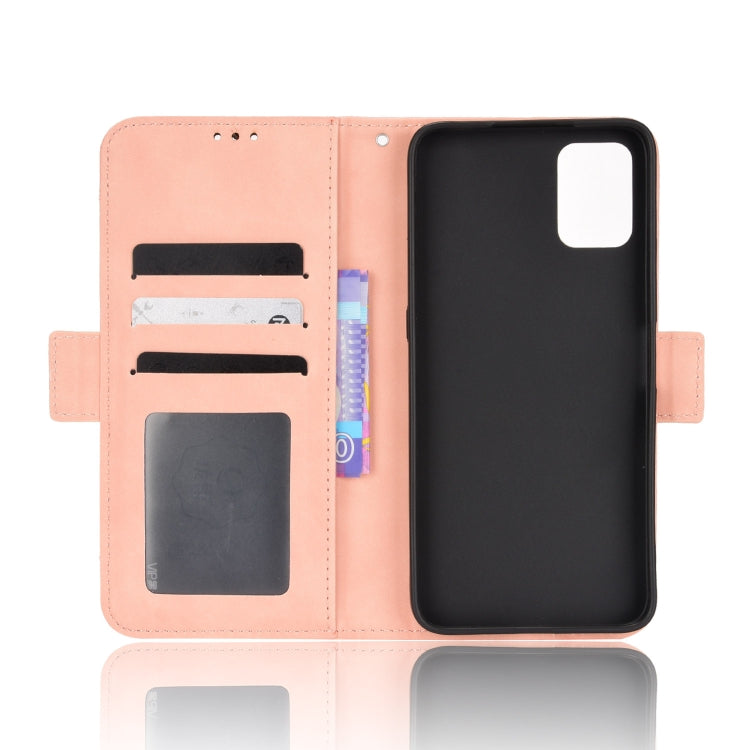 For Umidigi A11s Skin Feel Calf Pattern Leather Phone Case