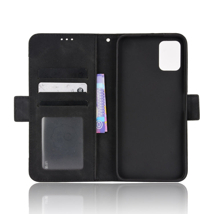 For Umidigi A11s Skin Feel Calf Pattern Leather Phone Case