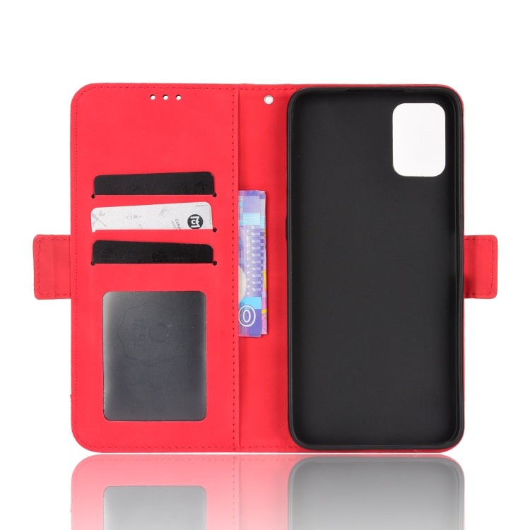For Umidigi A11s Skin Feel Calf Pattern Leather Phone Case