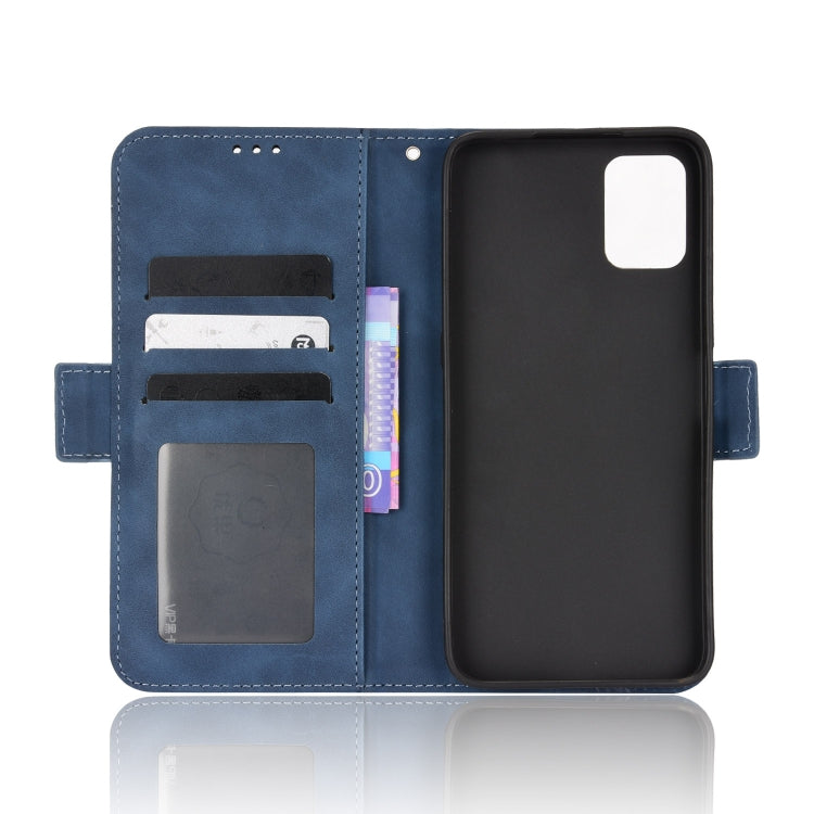 For Umidigi A11s Skin Feel Calf Pattern Leather Phone Case