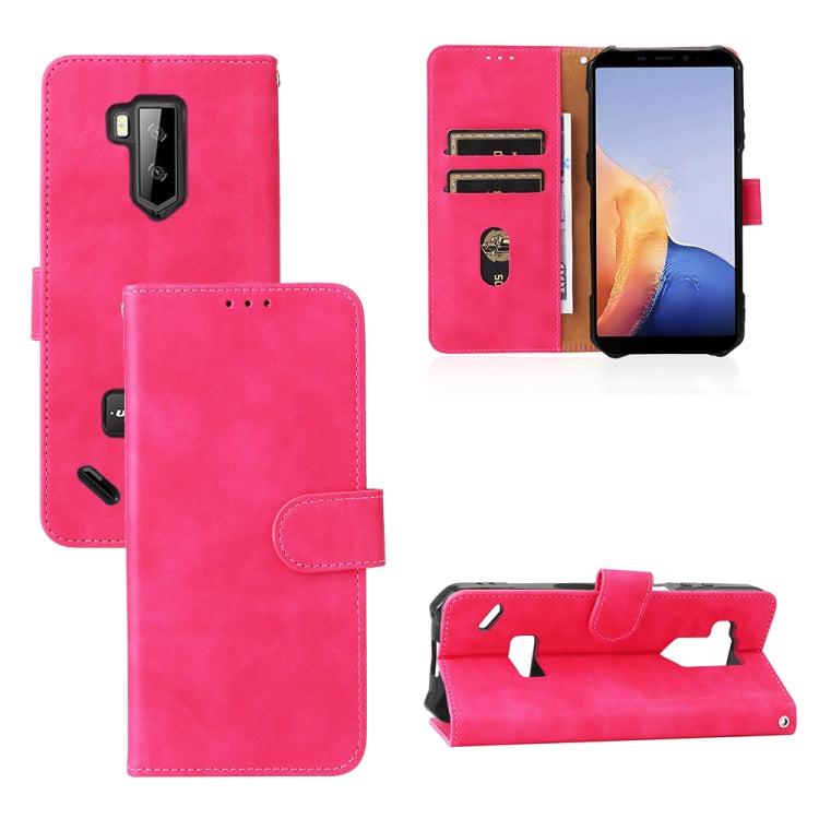 For Ulefone Armor X9 Skin Feel Magnetic Buckle Calf Texture PU Phone Case