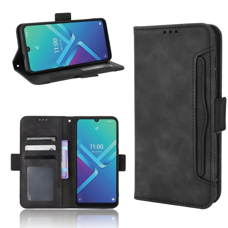 For Wiko Y82 Skin Feel Calf Pattern Leather Phone Case