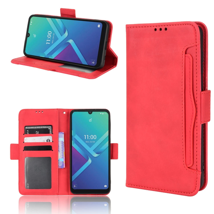 For Wiko Y82 Skin Feel Calf Pattern Leather Phone Case
