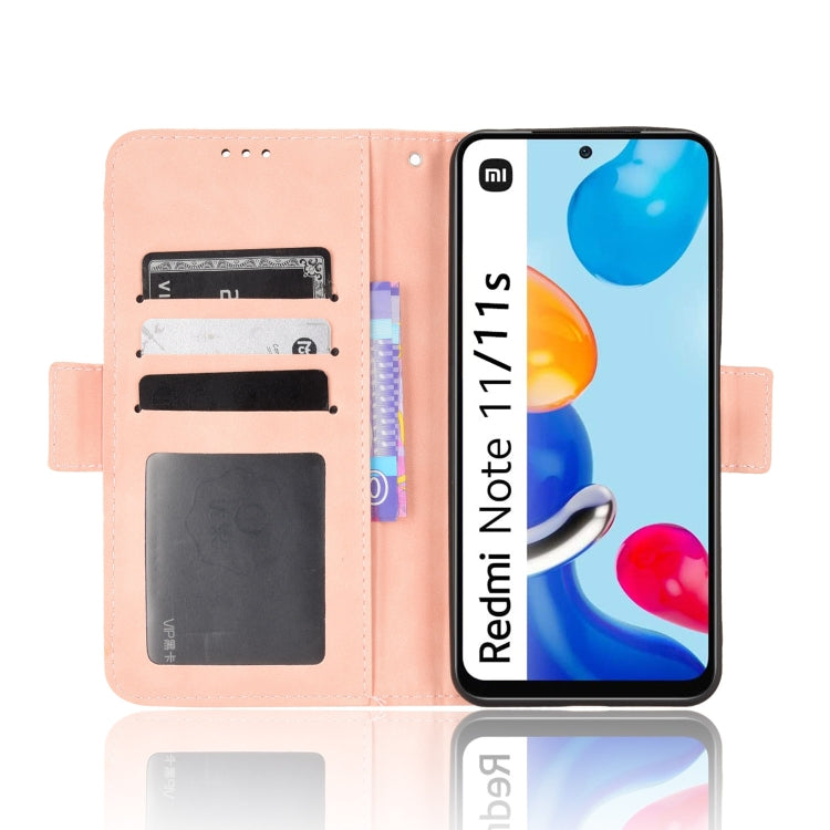 For Xiaomi Redmi Note 11S / Note 11 4G Overseas Version Skin Feel Calf Pattern Leather Phone Case